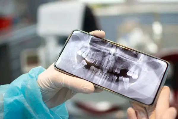 Qué es la odontología digital