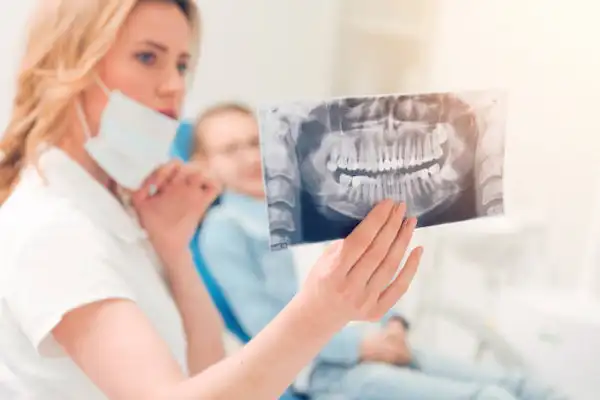 Tomografía CBCT en Implantología: Precisión, Tecnología y Confianza