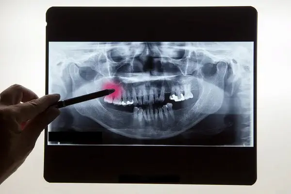Qué es la tecnología dental