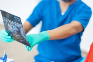 ¿Por qué la tomografía en endodoncia es clave para un diagnóstico exitoso?