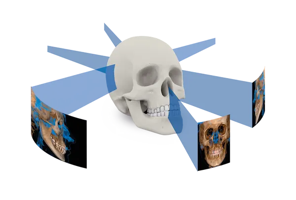 Aplicaciones en odontología de los tomógrafos dentales