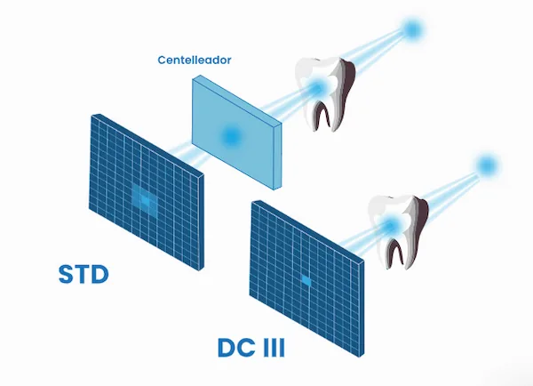 Gráfico que explica el proceso de la tecnología DC''' en el X-Radius Trio Plus