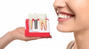 Rehabilitación oral ¿En qué consiste