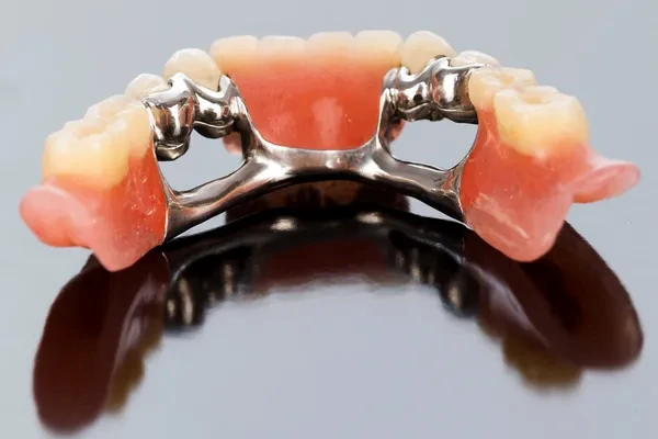 coronas y puentes para la rehabilitación dental