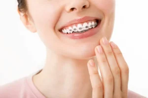 Qué son los brackets y cómo ayudan a mejorar tu sonrisa