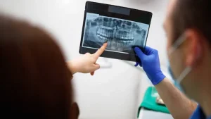 Ventajas de la radiografía dental