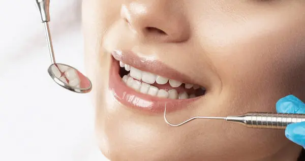 Qué tipos de caries existen y cuál es más común