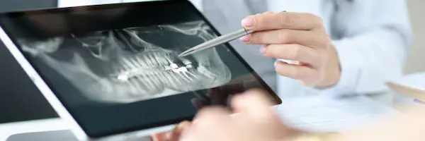 Beneficios concretos de la radiología digital en consultorios odontológicos