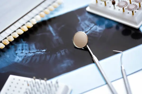 Errores comunes al seleccionar materiales para ortodoncia