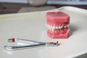 Instrumental de endodoncia