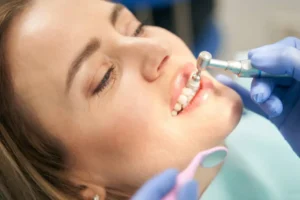 Equipos para una profilaxis dental