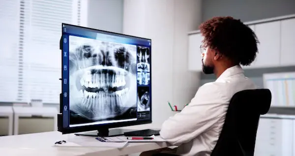 Beneficios de la imagenología dental