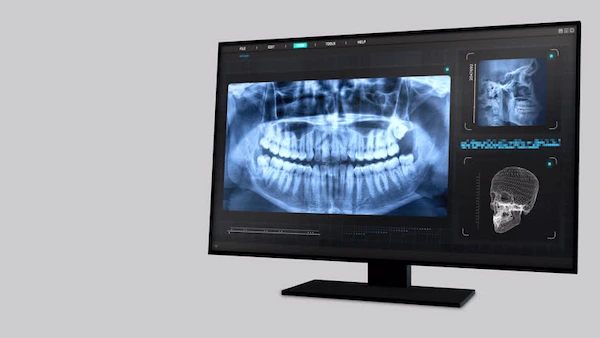 Innovación y futuro de la imagenología dental