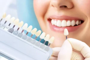 Materiales de restauración dental