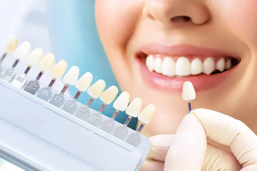 Materiales de restauración dental