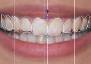 Odontología estética