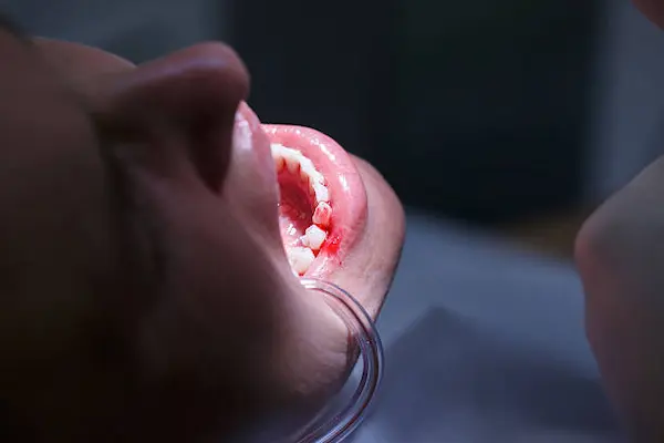 Infecciones bacterianas, virales y fúngicas