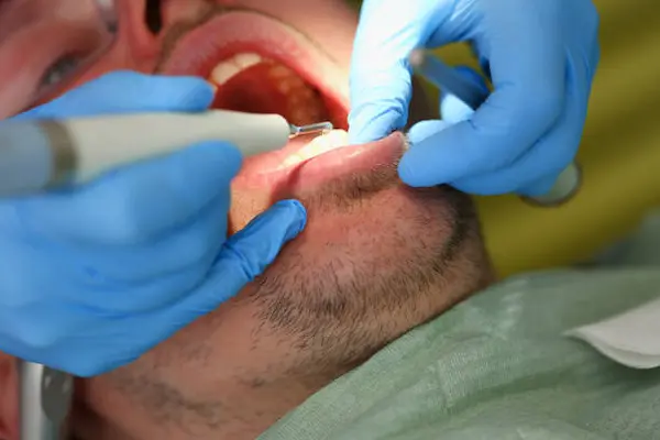Principales enfermedades tratadas en patología oral