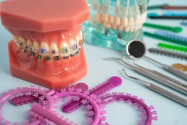 Principales instrumentos utilizados en ortodoncia