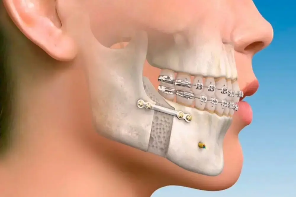 cirugía maxilofacial