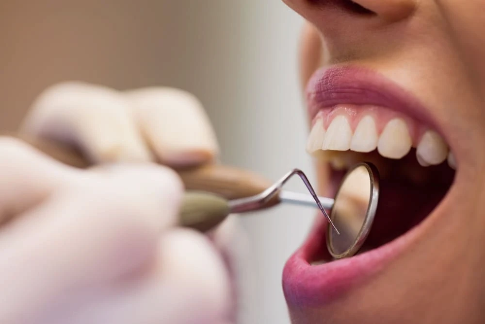 Recesión gingival